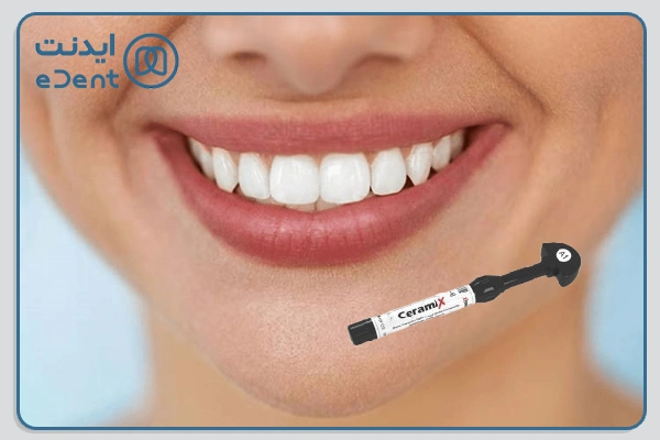 کامپوزیت سرامیکس ترایمدی یک کامپوزیت یونیورسال نانو سرامیکی با کیفیت و مناسب برای ترمیم دندان‌های قدامی و خلفی است.