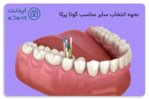 یکی از مهم‌ترین مراحل در درمان ریشه، انتخاب سایز مناسب گوتاپرکا است.