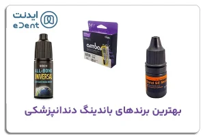 معرفی و بررسی بهترین باندینگ های دندانپزشکی