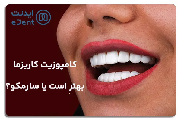 کامپوزیت کاریزما بهتر است یا سارمکو