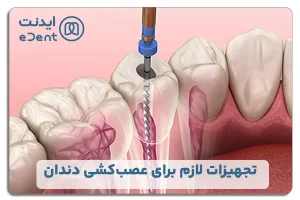 تجهیزات لازم برای عصب کشی دندان